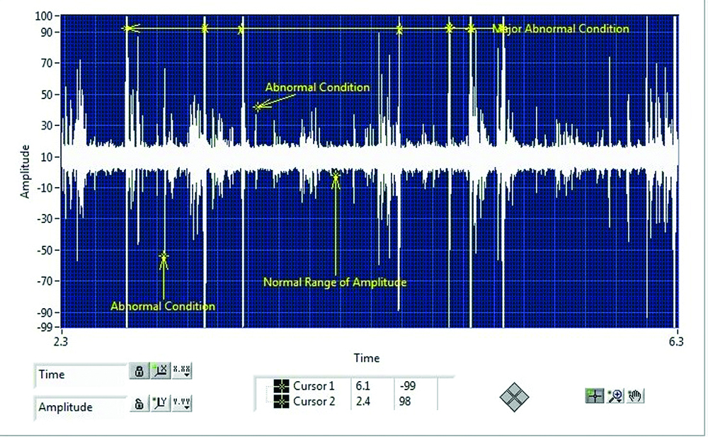 Sound analysis